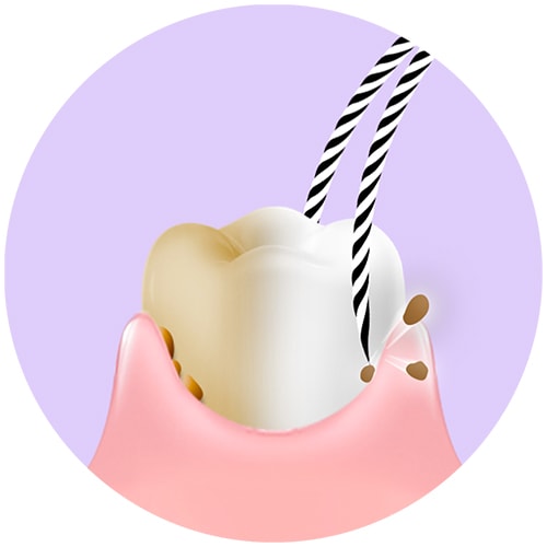 Bulu berus gigi berjalur membersih sisa makanan daripada gigi putih dan kuning